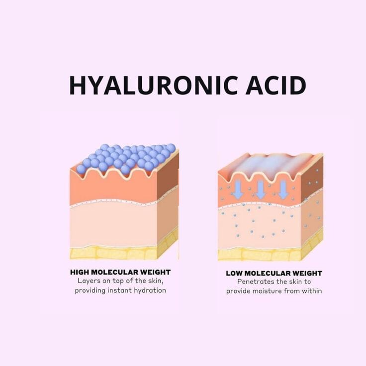 Understanding Hyaluronic Acid: Myth Vs Fact – 1stopfiller.com