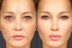 Aging Gracefully: How Dermal Fillers Can Help You Look Like the Best Version of Yourself