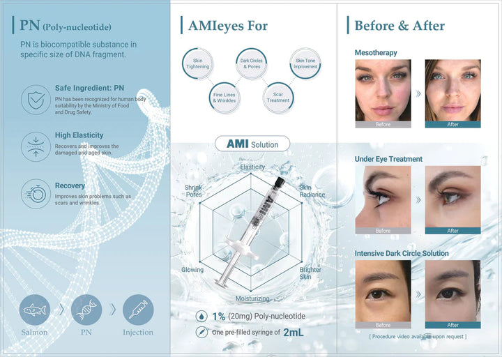 AMI EYES 1stopfiller.com 